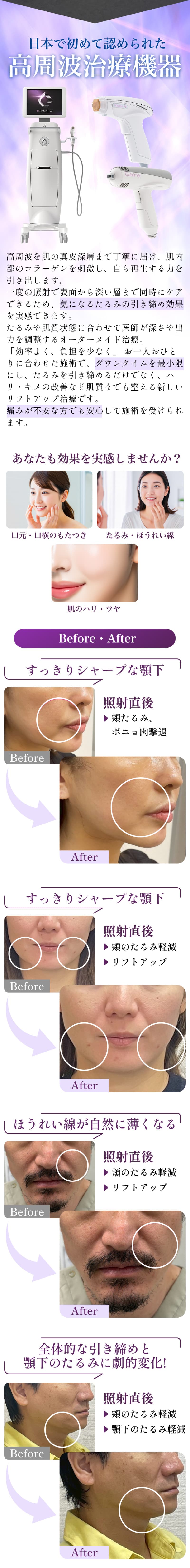 究極のアンチエイジング治療 NMN点滴